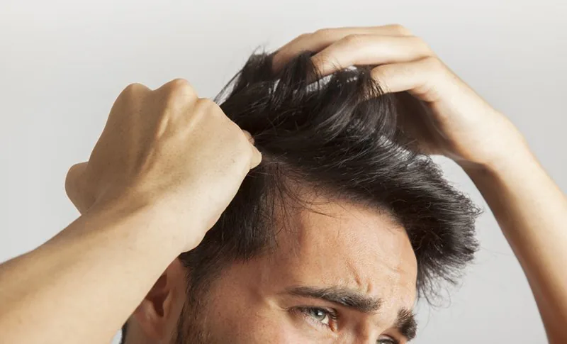 Hombre separándose el pelo con las manos para revisar el cuero cabelludo y la densidad de la zona frontal