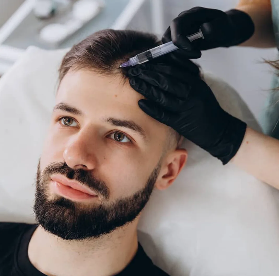 Mesoterapia capilar en Alfa Clinics Zaragoza