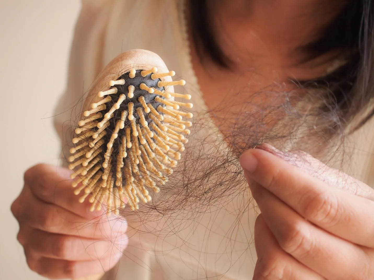 Pérdida de pelo en mujeres