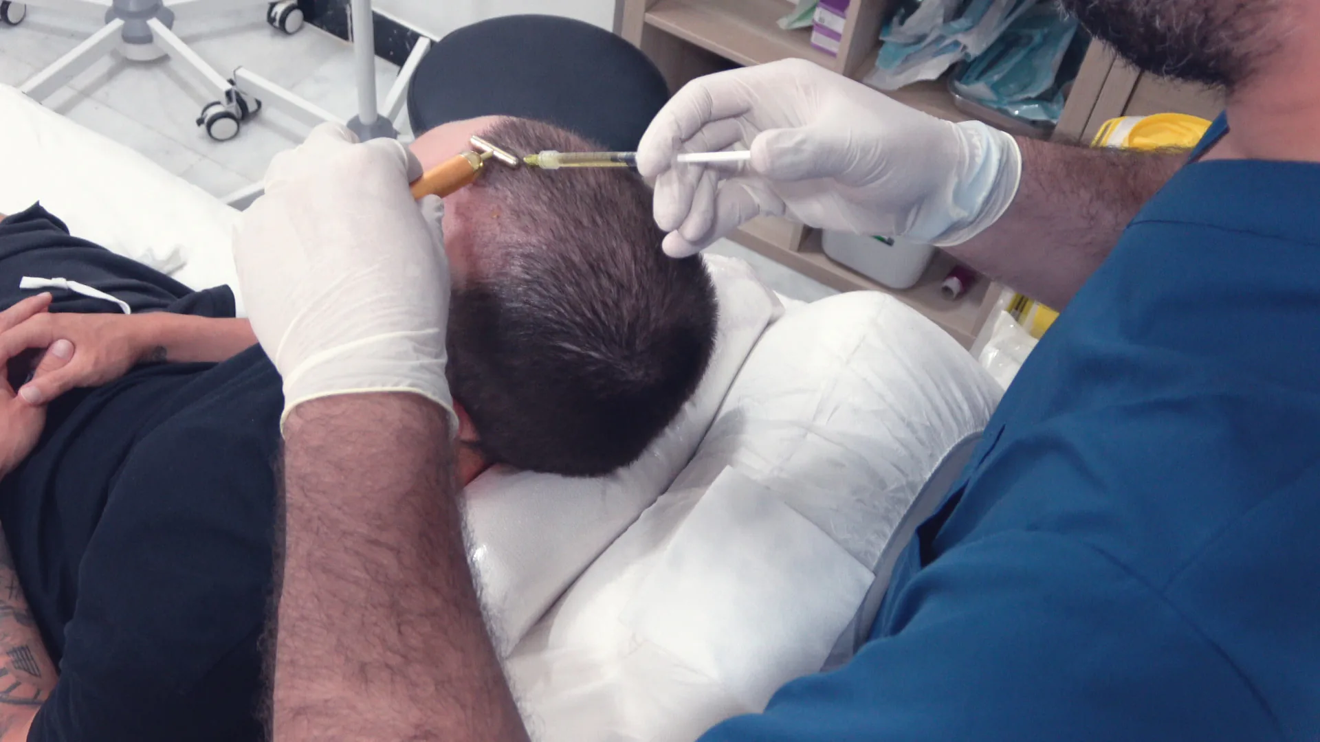 Profesional sanitario aplicando un tratamiento capilar con microinyecciones en el cuero cabelludo de un paciente en Alfa Clinics