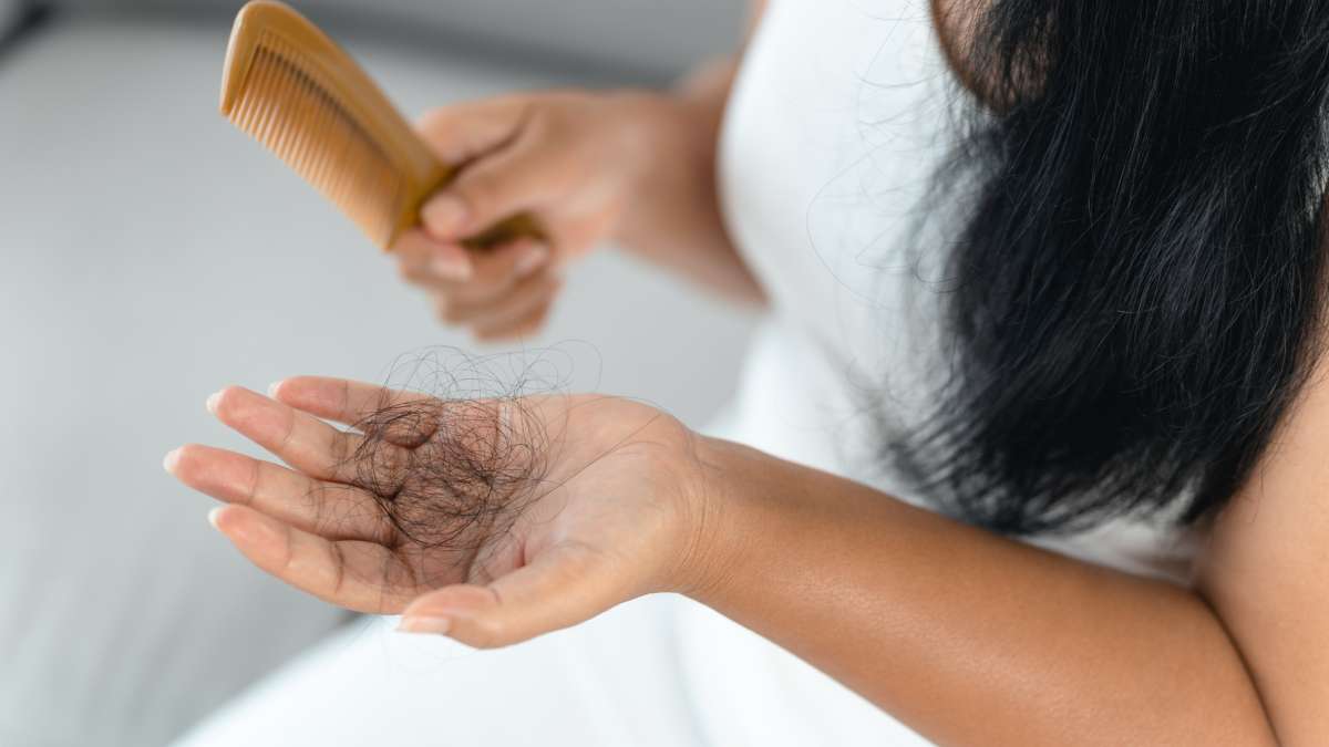 Alopecia femenina y opciones de tratamiento capilar