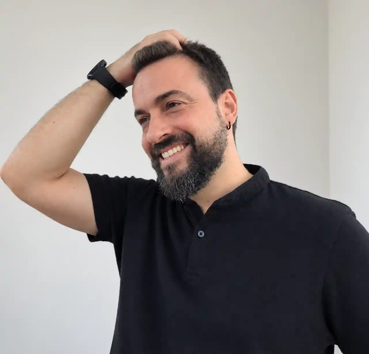 Injerto capilar en Zaragoza en Alfa Clinics